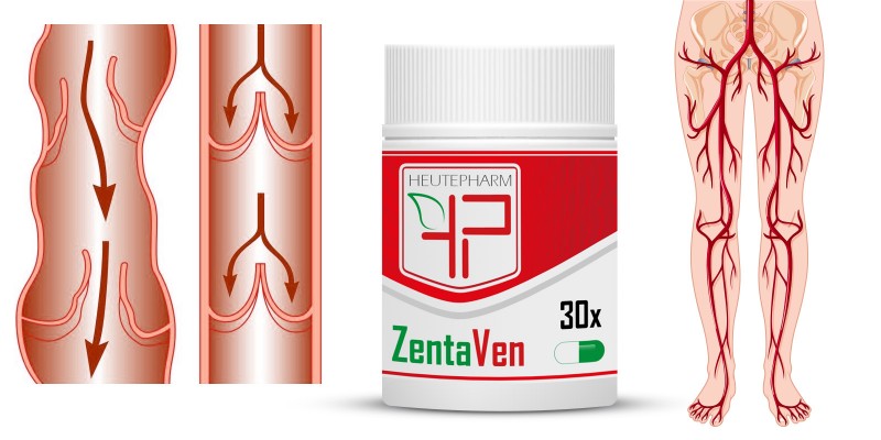 ZentaVen - Venenkapseln